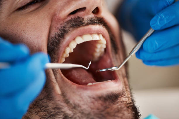 Best Urgent Tooth Repair  in High Bridge, WA